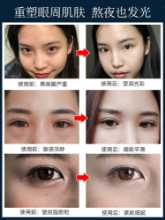 아이 서클 안티 링클의 그림